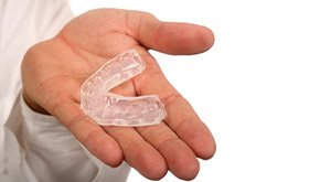 Closeup of hand holding occlusal splint in McKinney